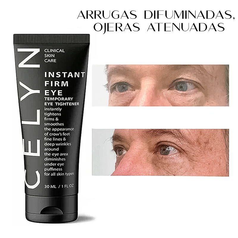 Crema anti-ojeras y arrugas instantánea Celyn