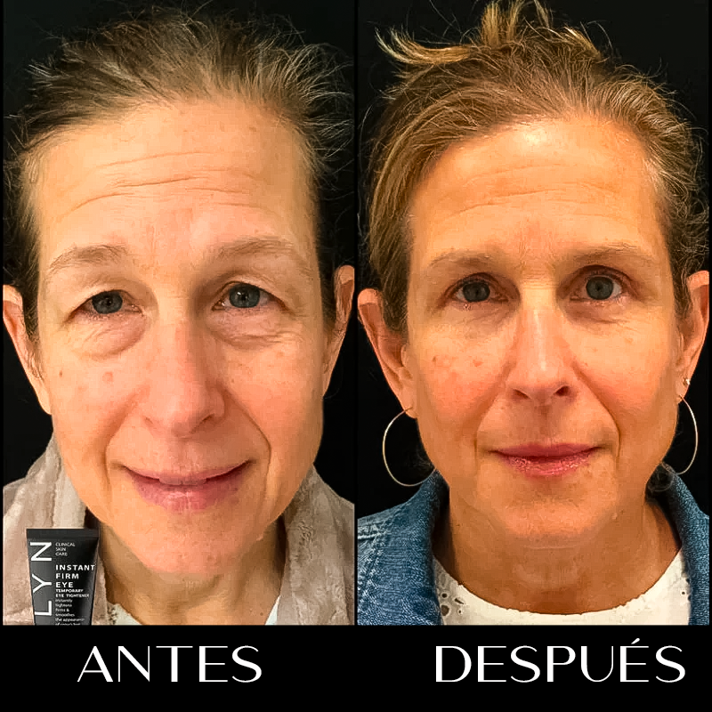 Crema anti-ojeras y arrugas instantánea Celyn