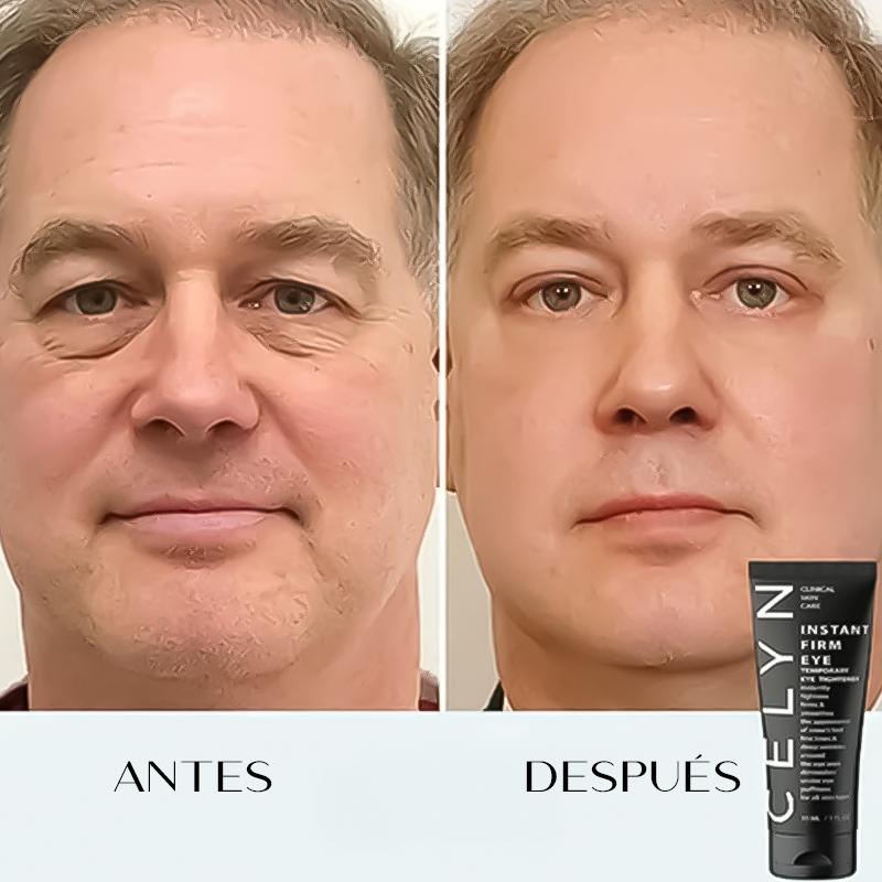 Crema anti-ojeras y arrugas instantánea Celyn