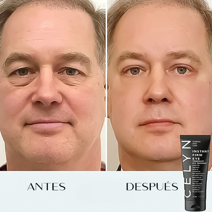 Crema anti-ojeras y arrugas instantánea Celyn